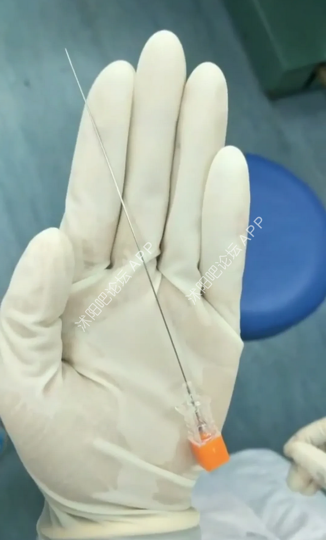 这是老婆剖腹产时麻醉用的针头,直到现在我都保留着这张照片